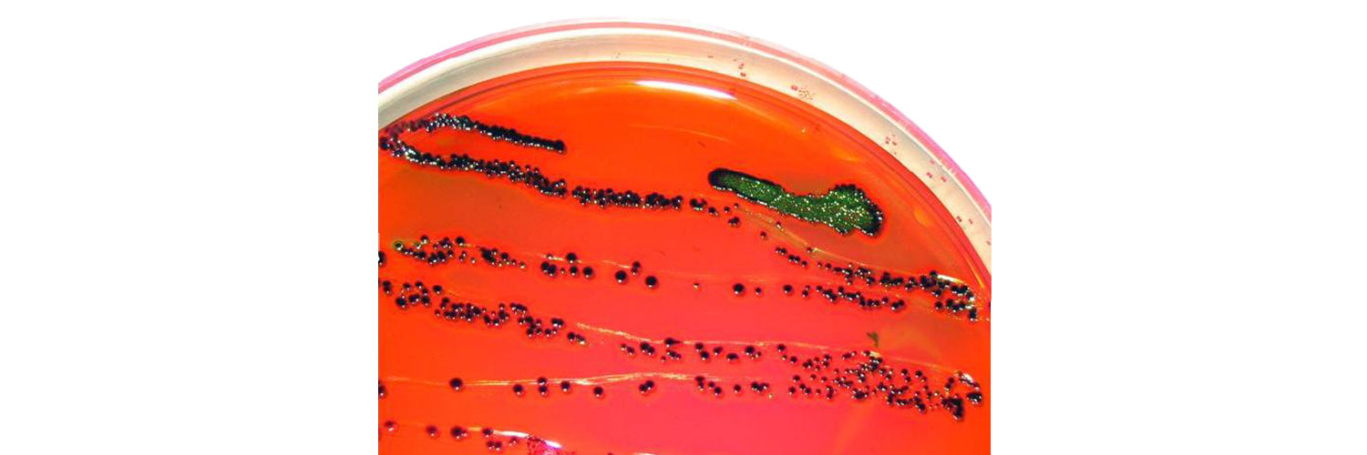 ترکیب E. coli با محیط کشت EMB آگار (E. coli on EMB agar)